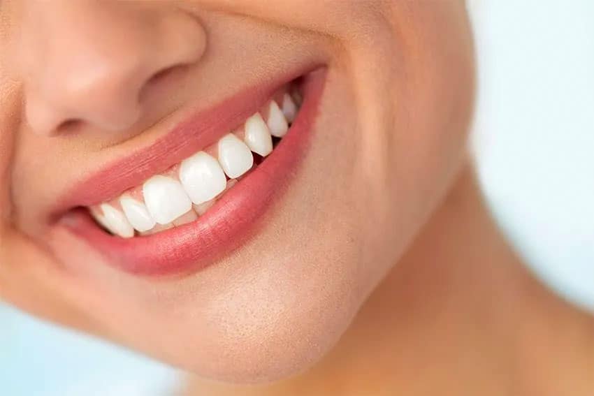 Veneers Price Philippines 2022 And Everything You Need To Know