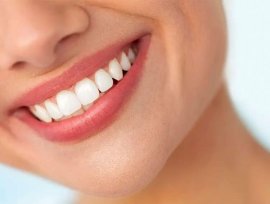 Veneers Price Philippines 2022 And Everything You Need To Know